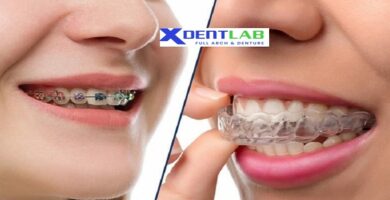 introduce Clear aligner export services