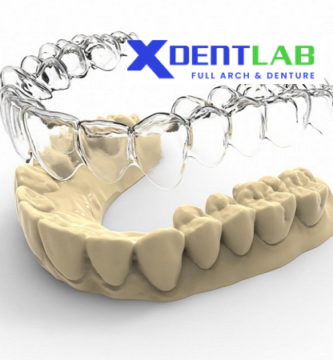 Custom-made clear aligners