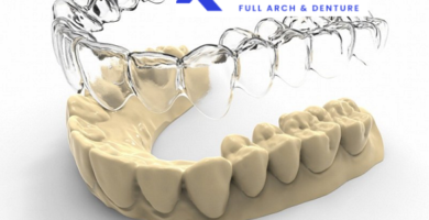 Custom-made clear aligners