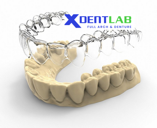 Custom-made clear aligners