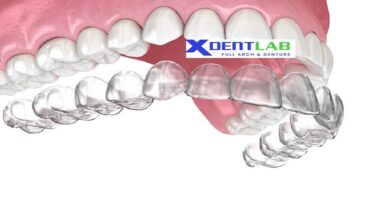 Global orthodontic labs for clear aligners