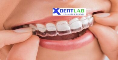 International clear aligner supplier
