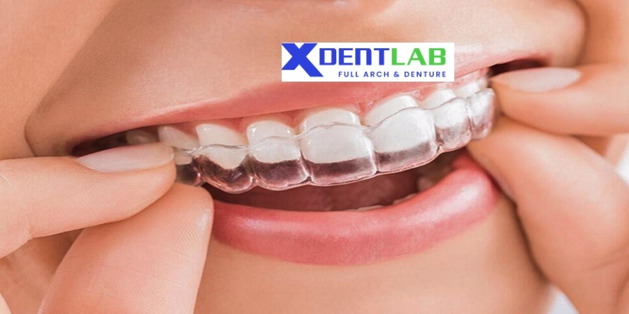 International clear aligner supplier