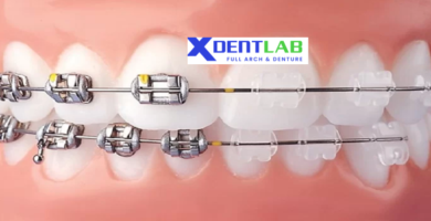 introduce Orthodontic aligner provider