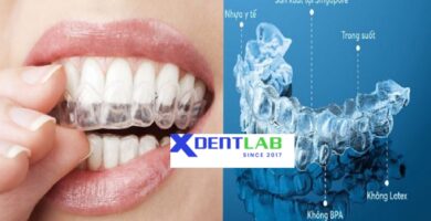 Global Clear Aligners Production