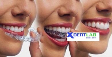 International dental aligner manufacturing