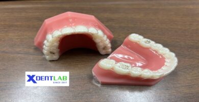 Top clear aligners manufacturing