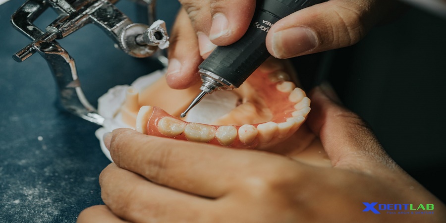Dental Labs in Vietnam District 2 Ho Chi Minh City