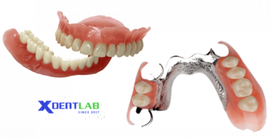 Removable Denture Lab District 12 Ho Chi Minh