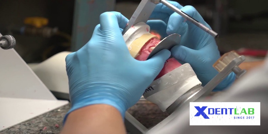 Vietnam Dental Laboratories District 7 Ho Chi Minh