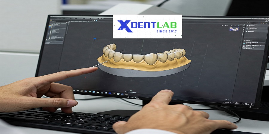 Vietnam dental lab District 6 Ho Chi Minh