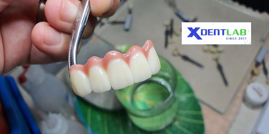 Removable Denture Lab District 6 Ho Chi Minh