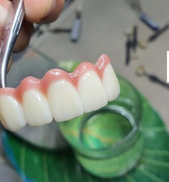 Vietnam dental lab district 1 Ho Chi Minh