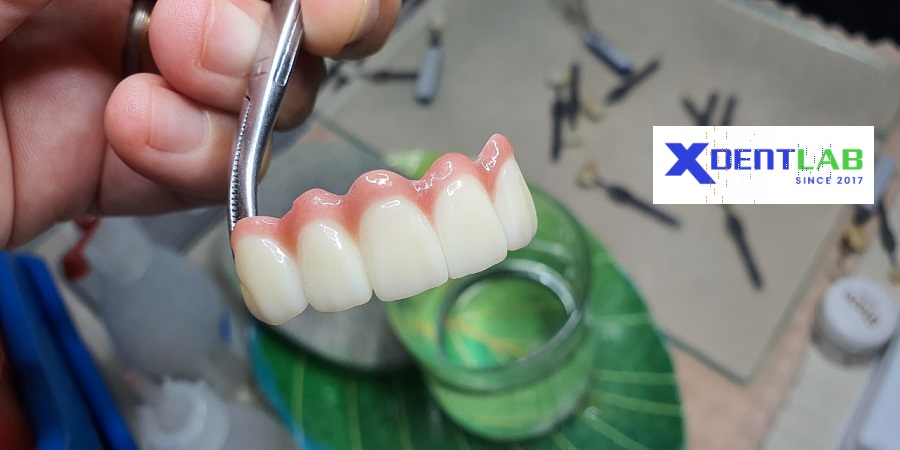 Vietnam dental lab district 1 Ho Chi Minh
